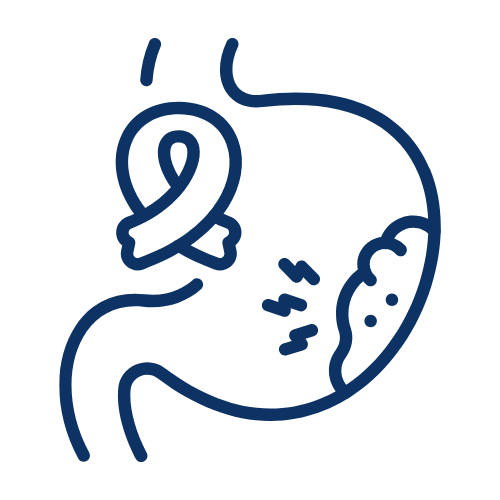 Stomach & Intestinal Cancers